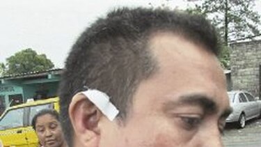 Concejal agrede a activista político