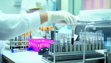 Caja de Seguro Social reconoce fallas en licitación de pruebas de laboratorio