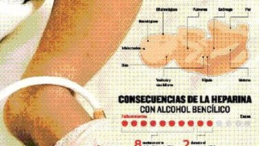 Camino tedioso para obtener una pensión