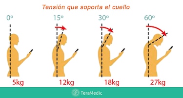 Tu teléfono podría estar dañando tu columna; descubre qué es el síndrome del cuello roto