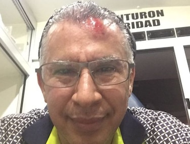 Director de la CSS, en reposo tras sufrir accidente vehicular
