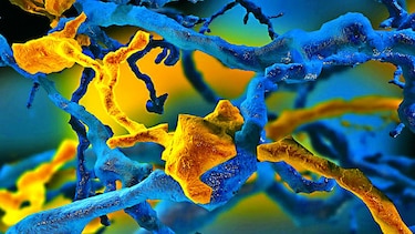 En los intrincados rincones del cerebro
