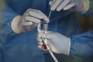 Salud investiga tres posibles casos de reinfección de covid-19 en diferentes provincias