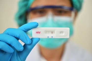 Panamá analiza el uso de las pruebas autoaplicadas de VIH