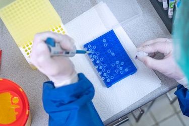 Estudio encontró la bacteria ‘Escherichia coli’ resistente a los antibióticos en perros domésticos