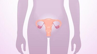 Vivir con endometriosis