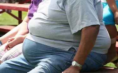 Obesidad y desnutrición se disparan en Centroamérica