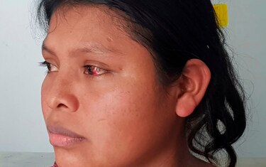 ‘Me dejaron ciega’ a golpes, dice una indígena que sobrevivió a la masacre en El Terrón