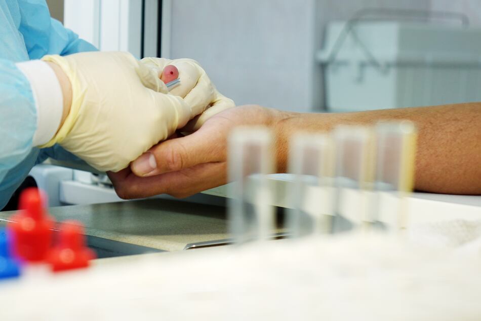 El VIH avanza en silencio: 7 de cada 10 personas llegan tarde al tratamiento