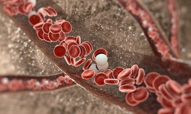 El 70% de la población sufre ateroesclerosis