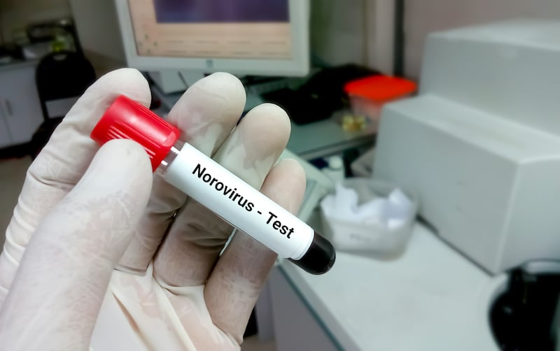 Qué es el norovirus que provocó el brote de gastroenteritis en la provincia de Chiriquí  