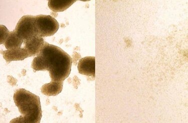 El zika demuestra ser un asesino para el tumor cerebral más mortífero
