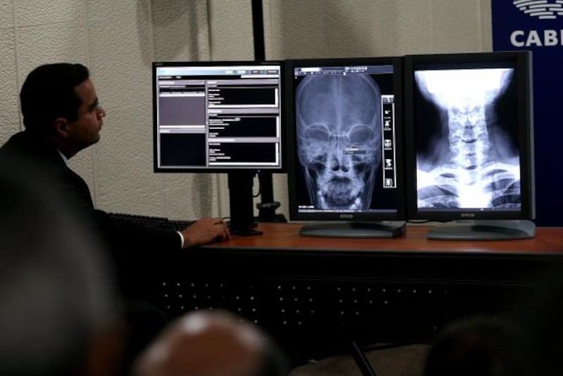 Servicio de Radiología suspendido en el Minsa por decisión unilateral de la empresa