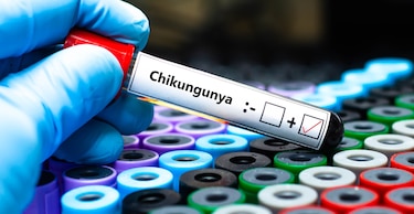 Panamá participa en el desarrollo de una vacuna contra el chikungunya