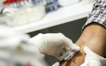 VIH, una de las principales causas de muerte en la comarca Ngäbe Buglé