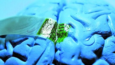 Epilepsia y marihuana