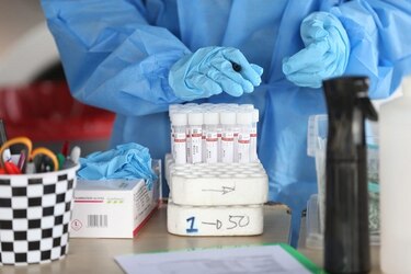 Minsa reporta 538 nuevos contagios de la Covid-19 y una positividad de 11.9%