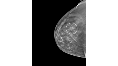 Las prioridades de la investigación en salud