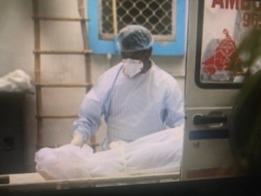 Uruguay registra caso de ‘hongo negro’ en un paciente recuperado de la Covid-19