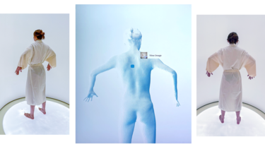 "Me hice un escáner que tomó 2.000 fotos de mi cuerpo y aprendí una inesperada lección sobre mi piel"