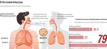 Panamá, en una batalla que no cesa contra la tuberculosis