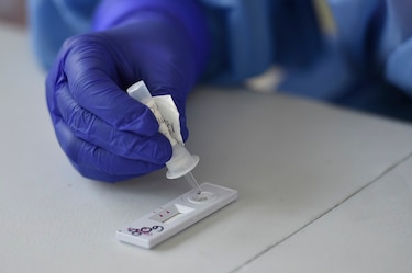 Colombia detecta primer caso de la variante brasileña del coronavirus