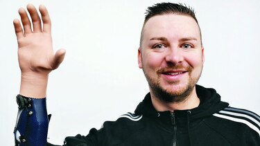 Tres austriacos con manos biónicas