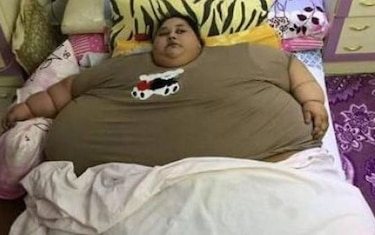Mujer que pesa 500 kilos será operada en India; no ha salido de su cuarto en 25 años