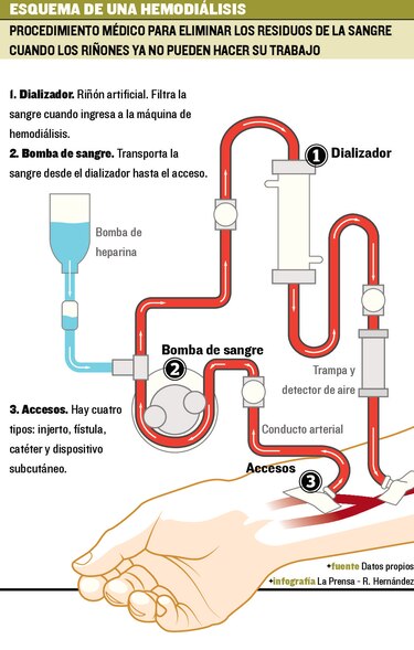 Jóvenes, enfermos de los riñones