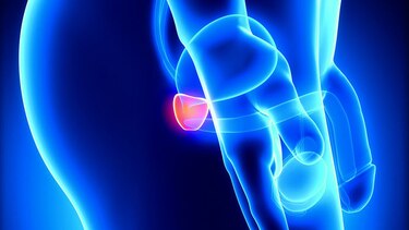 Otra opción terapéutica contra el cáncer de próstata