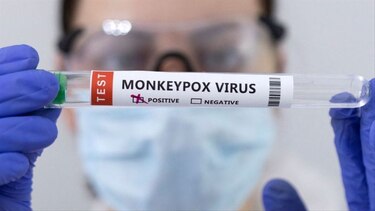 Panamá registra 79 casos de viruela del mono; entre estos, una mujer