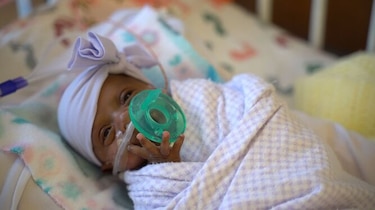Estados Unidos revela el nacimiento del bebé más pequeño del mundo
