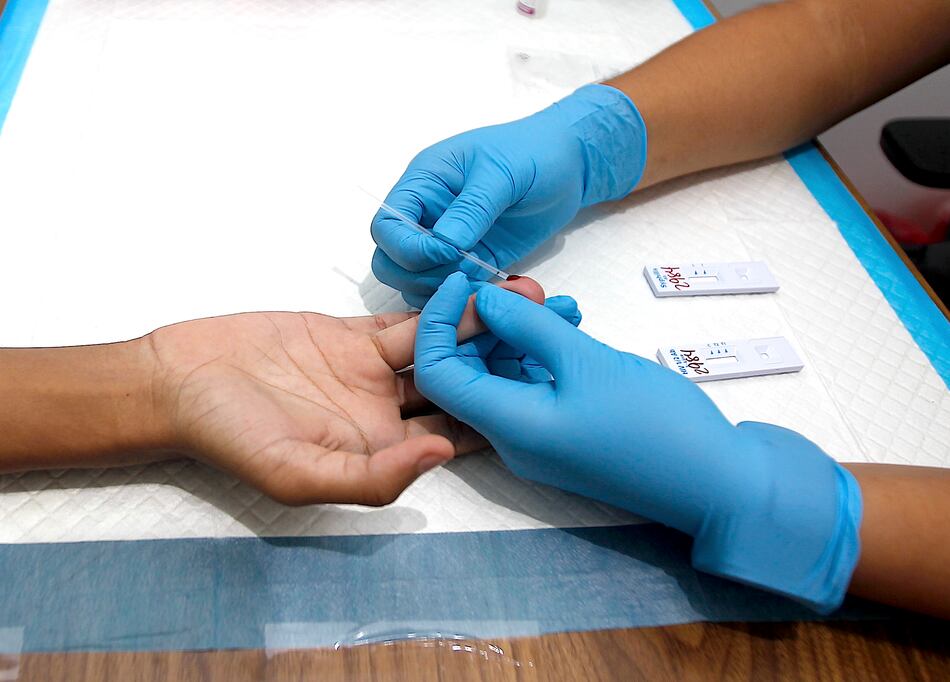 VIH en Panamá: casos estables, pero la mayoría de los diagnósticos llega tarde