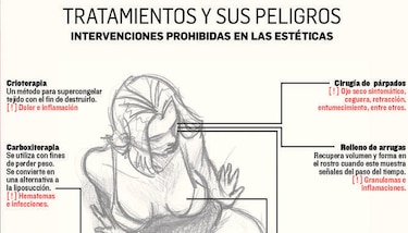 Minsa objeta proyecto que regula estéticas