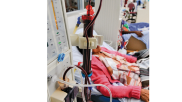CSS: más de 30 pacientes por mes ingresan a hemodiálisis