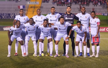 Copa Centroamericana: César Aguilar confía en revertir la serie