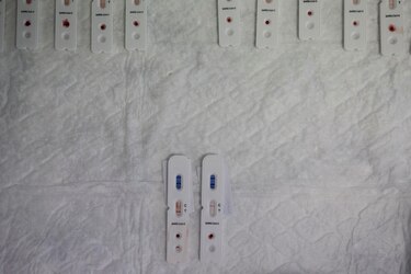 Un estudio revela que la covid-19 deteriora el sistema inmunitario a largo plazo