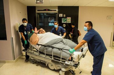 Hombre más obeso del mundo sometido con éxito a reducción de estómago en México