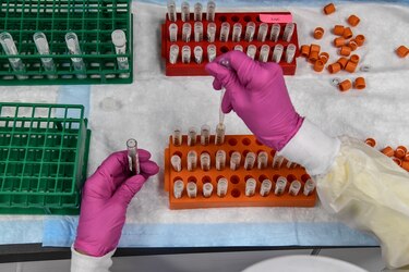 Estados Unidos espera iniciar vacunación contra la Covid-19 a principios de diciembre