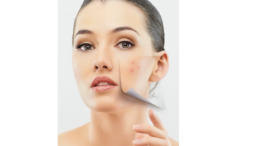 Desechos plásticos son un lado desagradable de la belleza