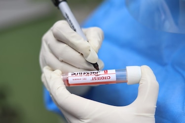 Panamá, sin lograr el control esperado de la epidemia: Néstor Sosa