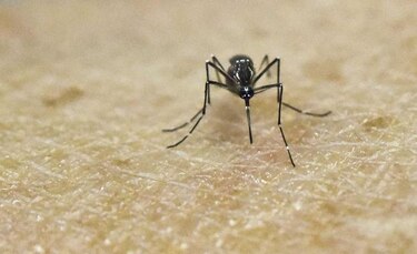 Científicos de Estados Unidos confirman vínculo entre zika y microcefalia en fetos