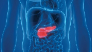 Nuevo fármaco frena el cáncer de páncreas