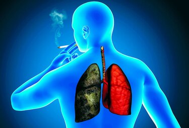 Panamá será sede de la conferencia latinoamericana sobre cáncer de pulmón