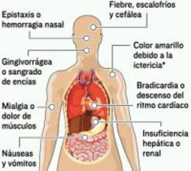 Gorgas y Minsa refuerzan vigilancia de fiebre amarilla en frontera con Colombia