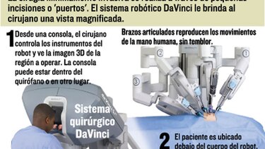 Robots en el quirófano