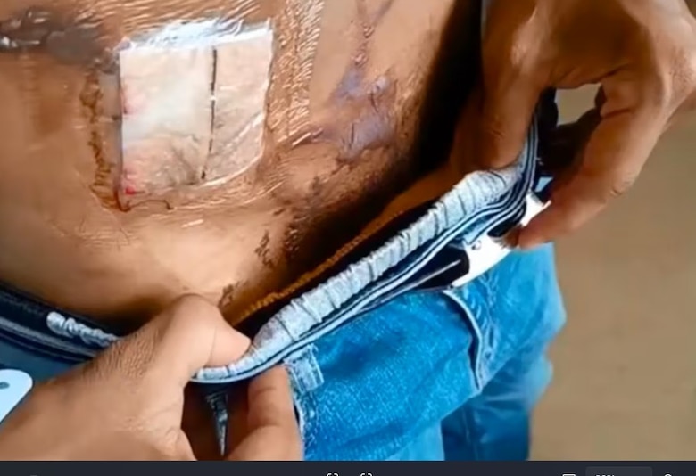 Otro incidente en el Hospital Nicolás A. Solano: suspenden turnos de médico por situación que dejó a paciente con quemaduras