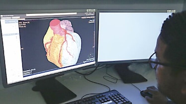 Concluye modernización de servicio de radiología