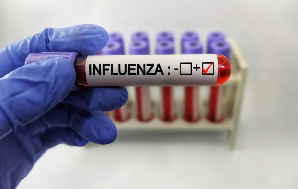 De 10 a 50 contagios: cómo las fiestas navideñas pueden acelerar la influenza