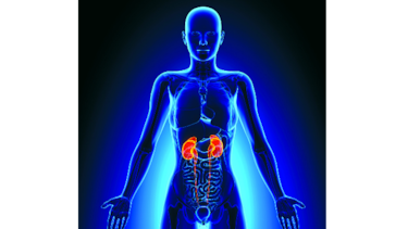 Cinco mitos de la insuficiencia renal
